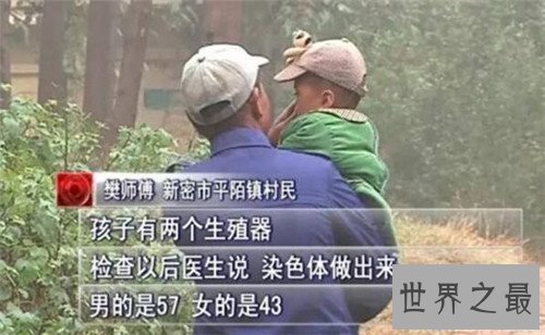 【图】阴阳人图片构成缘由引见 泰国人妖并不属于阴阳