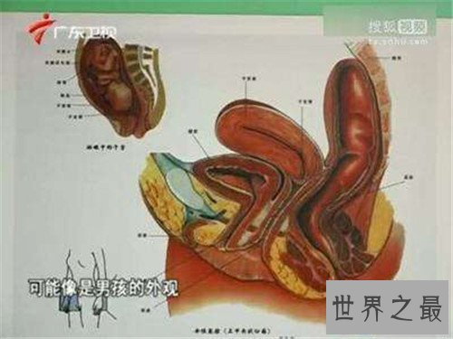 【图】阴阳人图片构成缘由引见 泰国人妖并不属于阴阳