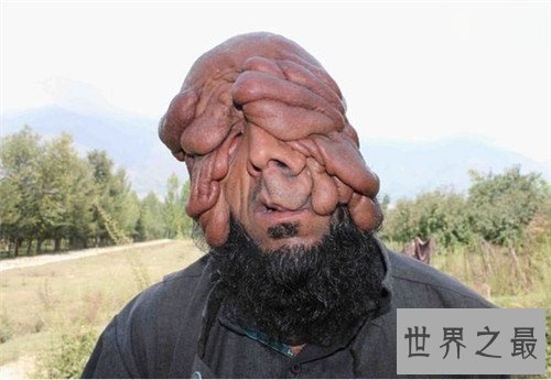 【图】最丑的男人脸部长瘤五官变样 乌干达最丑男人靠
