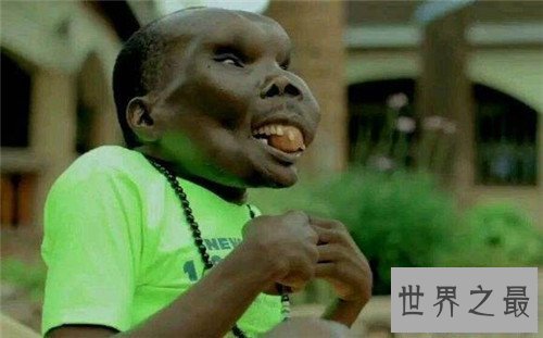 【图】最丑的男人脸部长瘤五官变样 乌干达最丑男人靠