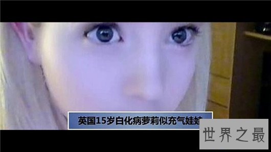 【图】15岁白化病萝莉面貌受宅男追捧,被奉为真人版充