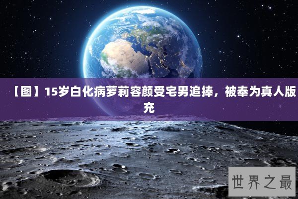 【图】15岁白化病萝莉容颜受宅男追捧,被奉为真人版充 【图】15岁白化病萝莉容颜受宅男追捧,被奉为真人版充
