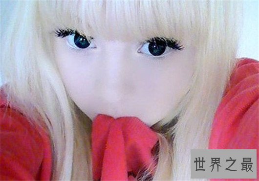 【图】15岁白化病萝莉面貌受宅男追捧,被奉为真人版充