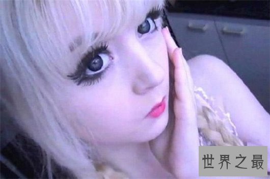 【图】15岁白化病萝莉面貌受宅男追捧,被奉为真人版充