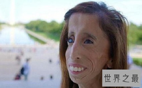 【图】世界上最丑的女人 然而她却领有漂亮的心灵