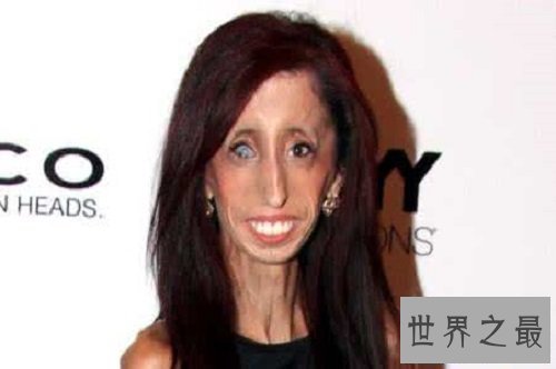 【图】世界上最丑的女人 然而她却领有漂亮的心灵