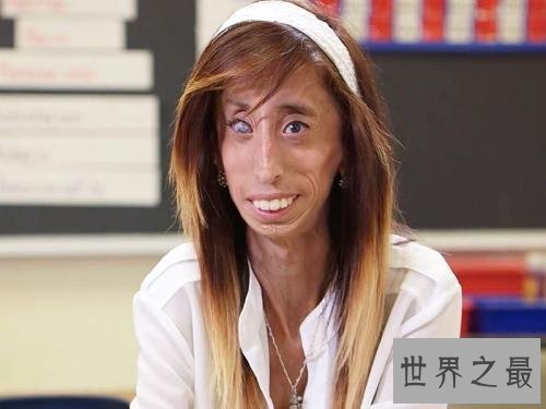 【图】世界上最丑的女人 然而她却领有漂亮的心灵