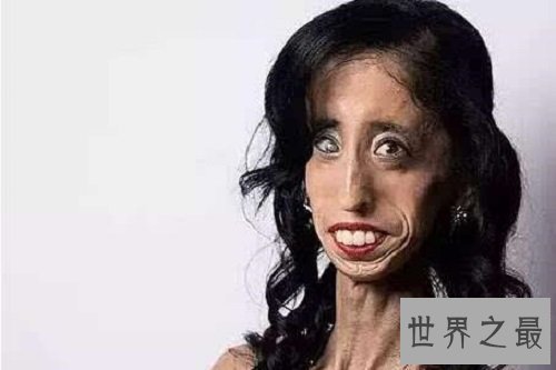 【图】世界上最丑的女人 然而她却领有漂亮的心灵