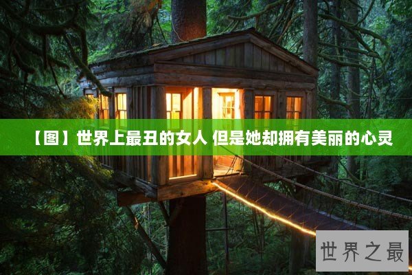 【图】世界上最丑的女人 但是她却拥有美丽的心灵 【图】世界上最丑的女人 但是她却拥有美丽的心灵