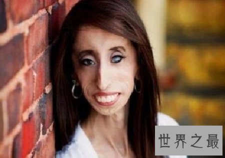【图】世界上最丑的女人 然而她却领有漂亮的心灵