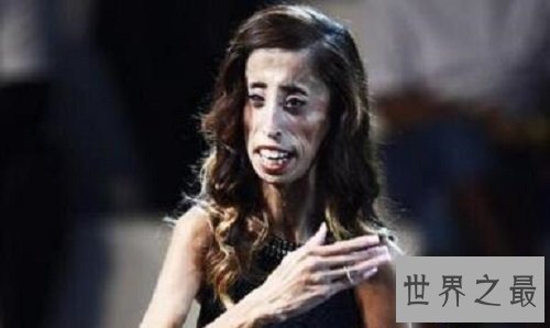 【图】世界上最丑的女人 然而她却领有漂亮的心灵