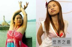 【图】芙蓉姐姐早期丑女图片 如今逆袭成女神求婚王宝