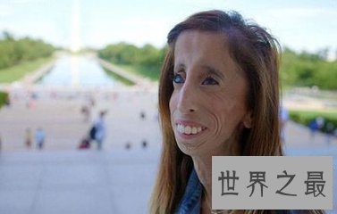 【图】如今的人们都谋求瘦身 以为瘦才是最美的 世界上