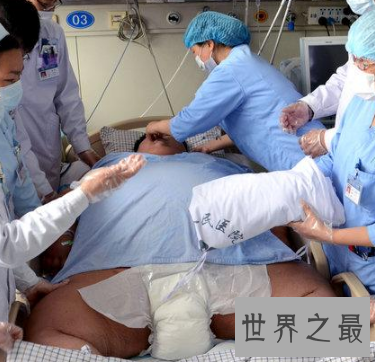 【图】中国第一胖 到底有多胖能力导致心脏衰竭死亡