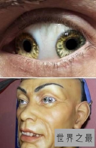 【图】双瞳人让人感到恐惧但其实他们和一般人一样