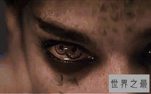【图】双瞳人让人感到恐惧但其实他们和一般人一样