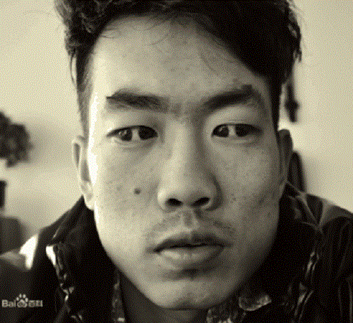 【图】双瞳人让人感到恐惧但其实他们和一般人一样