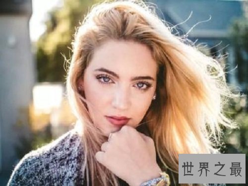 【图】双瞳人让人感到恐惧但其实他们和一般人一样