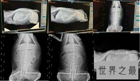 【图】一种可能治病的同时也可能迫害人的技术浣肠
