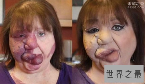 【图】最恶心的图片有哪些 世界上最恶心的男人与女人