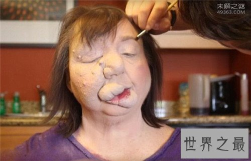 【图】最恶心的图片有哪些 世界上最恶心的男人与女人