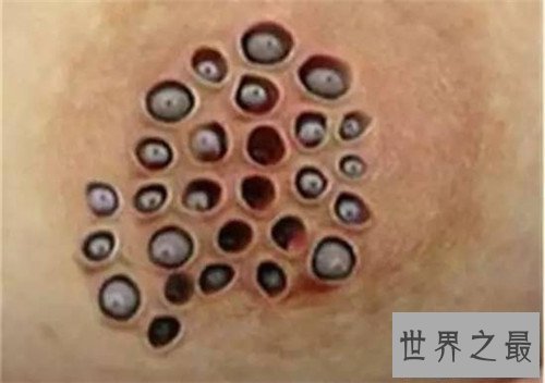 【图】最恶心的图片有哪些 世界上最恶心的男人与女人