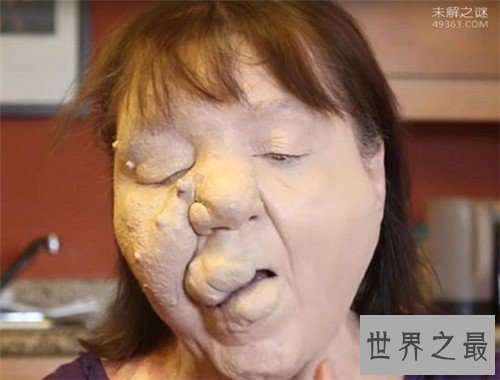 【图】最恶心的图片有哪些 世界上最恶心的男人与女人