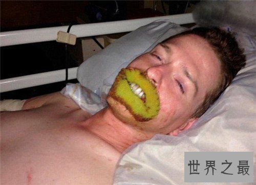 【图】最恶心的图片有哪些 世界上最恶心的男人与女人