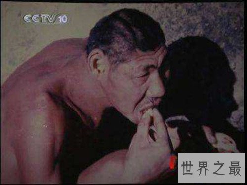 【图】猴娃之谜的假相是什么 科学家示意竟然是这种病