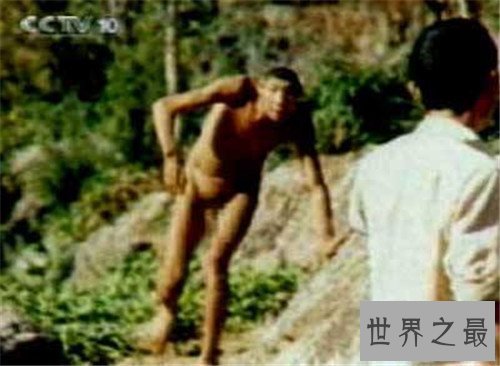 【图】猴娃之谜的假相是什么 科学家示意竟然是这种病