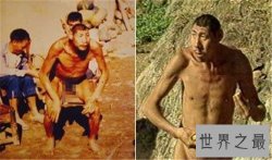 【图】猴娃之谜的真相是什么 科学家表示竟然是这种病