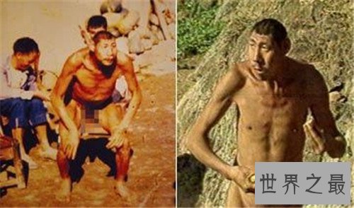 【图】猴娃之谜的假相是什么 科学家示意竟然是这种病