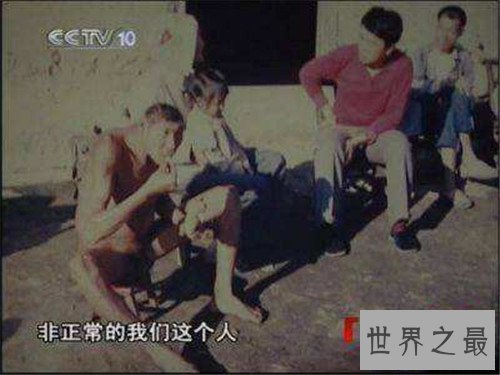 【图】猴娃之谜的假相是什么 科学家示意竟然是这种病