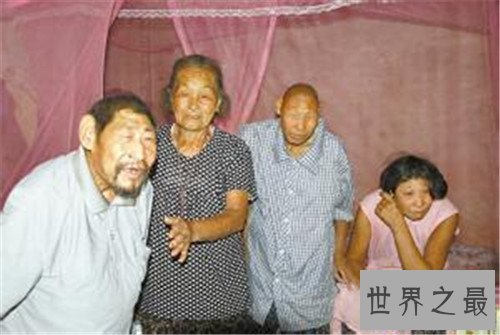 【图】猴娃之谜的假相是什么 科学家示意竟然是这种病