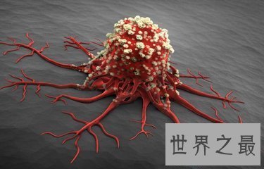 【图】人的身材中有很多的器官 那么人体最大的器官是