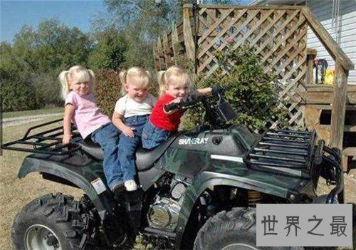 【图】连体婴儿长什么样 曾有连体婴儿胜利做完手术