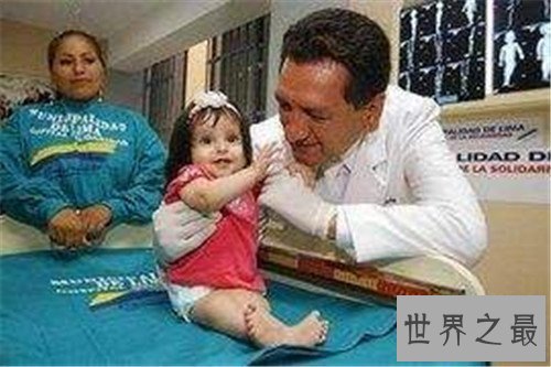 【图】不老症并不是长生不老 美国女童17岁仍是女婴