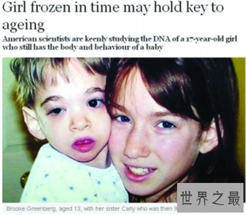 【图】不老症并不是长生不老 美国女童17岁仍是女婴