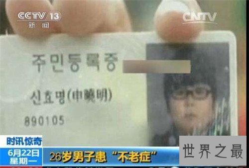 【图】不老症并不是长生不老 美国女童17岁仍是女婴