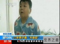 【图】不老症并不是长生不老 美国女童17岁仍是女婴