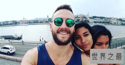 【图】双头人在这个世界上是怎样生存上去的