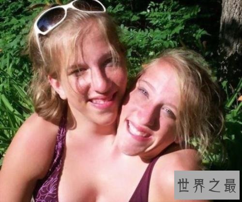 【图】双头人在这个世界上是怎样生存上去的