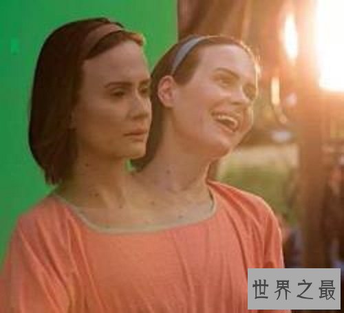 【图】双头人在这个世界上是怎样生存上去的