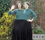 【图】双头人在这个世界上是怎么生活下来的