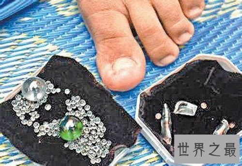 【图】怪病都有哪些呢 曾有女孩皮肤始终长金属丝