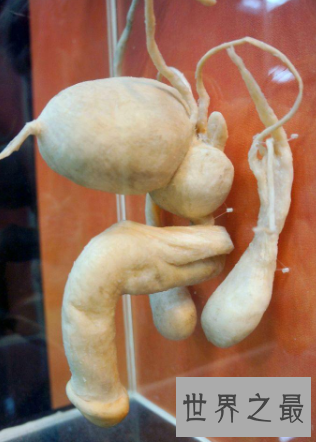 【图】男性生殖那些你不能不懂得瘦弱常识秘密