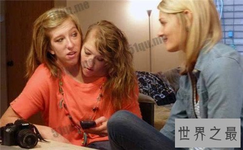 【图】阿比盖尔和布列塔妮系双头美女 她们示意不能嫁