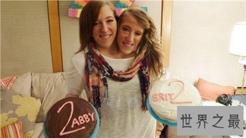 【图】阿比盖尔和布列塔妮系双头美女 她们示意不能嫁