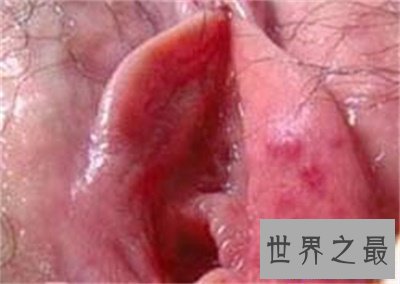 【图】女性生殖器官真的太难看了