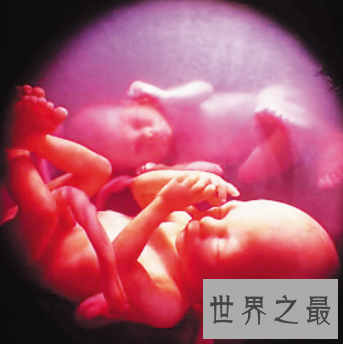 【图】多胞胎真的会给一个家庭幸福吗 是或许不是呢